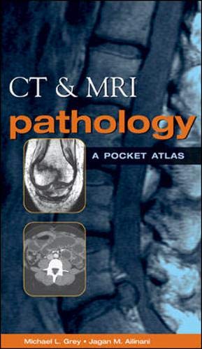 CT & MRI Pathology: A Pocket Atlas