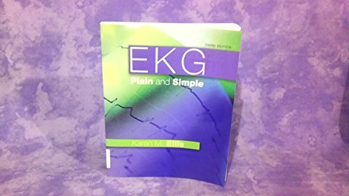 EKG Plain and Simple