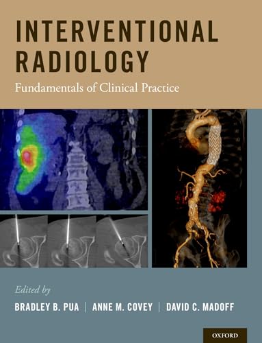 Interventional Radiology: Fundamentals of Clinical Practice
