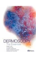 Dermoscopy