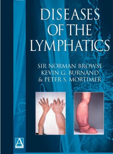Diseases of the Lymphatics