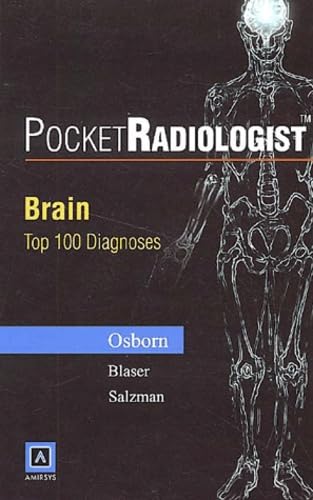 PocketRadiologist: Brain Top 100 Diagnoses