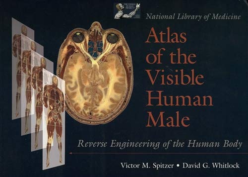 National Library of Medicine Atlas of the Visible Human Male: Reverse Engineering of the Human Body