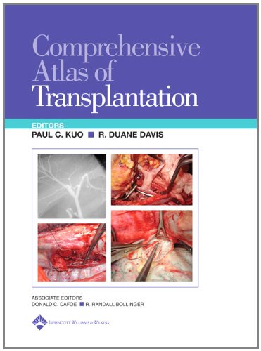 Comprehensive Atlas of Organ Transplantation
