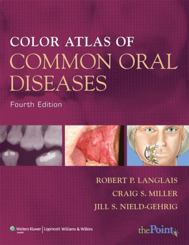 COLOR ATLAS OF COMMON ORAL DISEASES 4E: .
