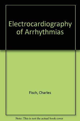 Electrocardiography of Arrhythmias