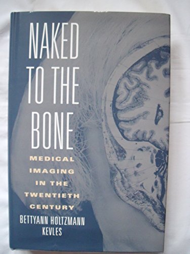 Naked to the Bone: Medical Imaging in the Twentieth Century (Sloan Technology Series)
