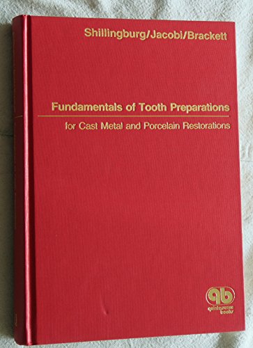 Fundamentals of Tooth Preparations for Cast Metal and Porcelain Restorations
