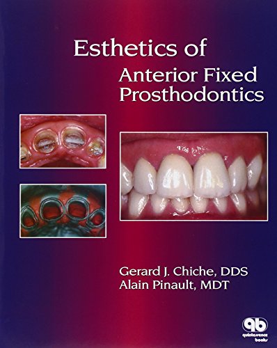 Esthetics of Anterior Fixed Prosthodontics