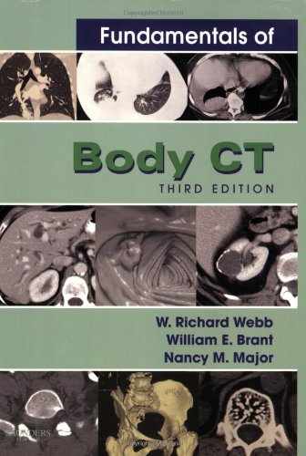 Fundamentals of Body Ct (3rd Edition)
