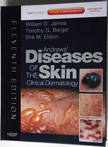 Andrews' Diseases of the Skin: Clinical Dermatology - Expert Consult - Online and Print