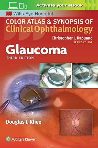 Glaucoma (Color Atlas and Synopsis of Clinical Ophthalmology)