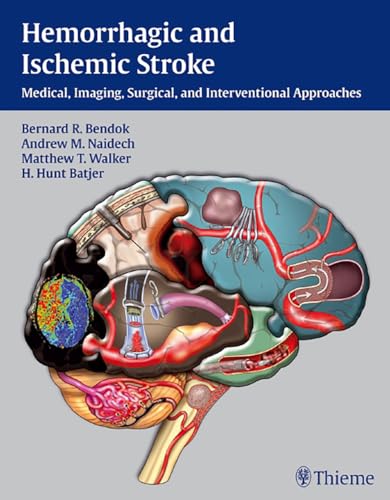 Hemorrhagic and Ischemic Stroke: Medical, Imaging, Surgical and Interventional Approaches