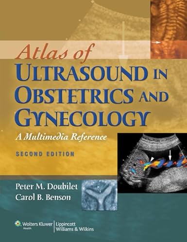 No Image Available