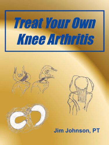 Treat Your Own Knee Arthritis