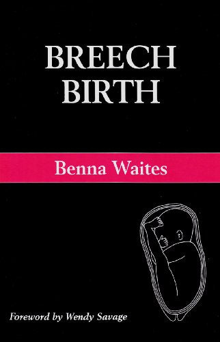 Breech Birth
