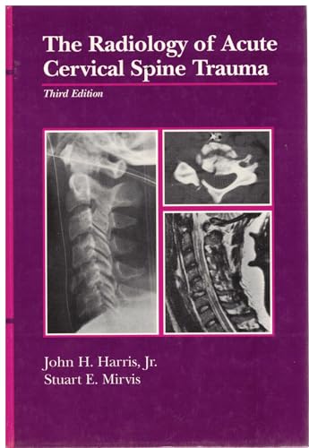 The Radiology of Acute Cervical Spine Trauma