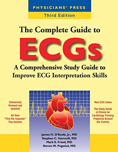 The Complete Guide to ECGs: .