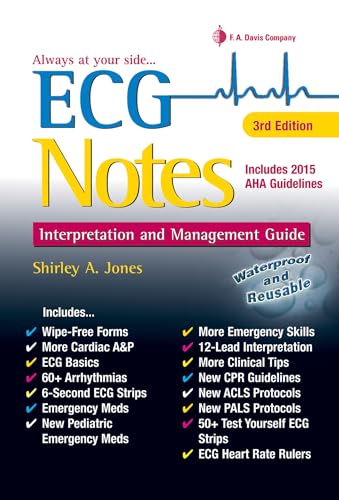 ECG Notes: Interpretation and Management Guide
