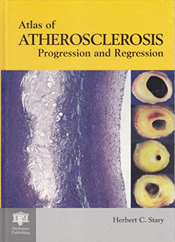 An Atlas of Atherosclerosis Progression and Regression
