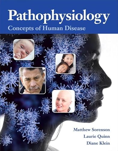 Pathophysiology: Concepts of Human Disease