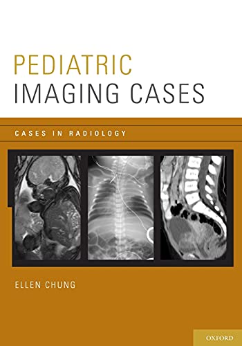 Pediatric Imaging Cases (Cases in Radiology)
