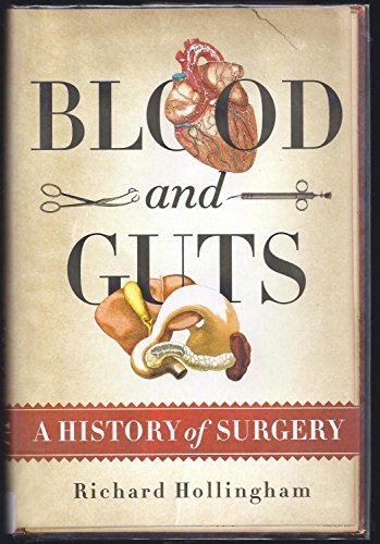 Blood and Guts: A History of Surgery