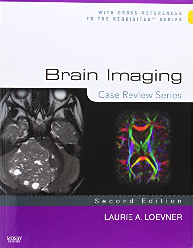 Brain Imaging: Case Review Series