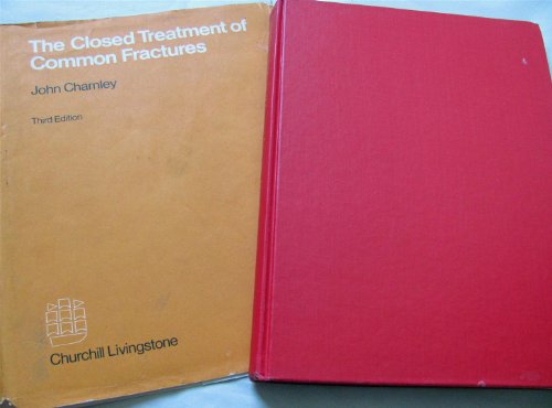 Closed Treatment of Common Fractures