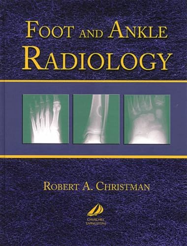 Foot and Ankle Radiology