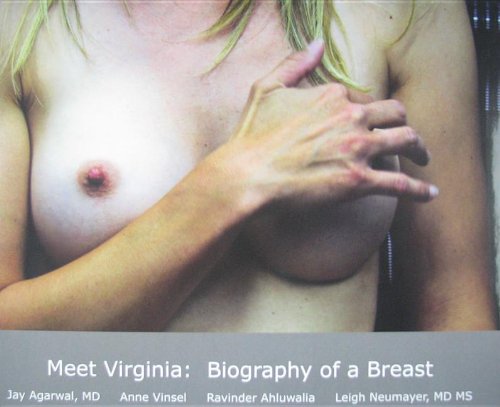 Meet Virginia : Biography of a Breast