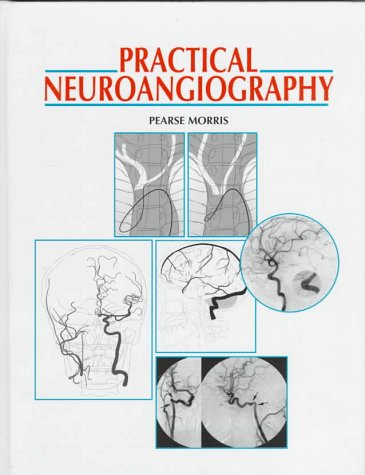 Practical Neuroangiography