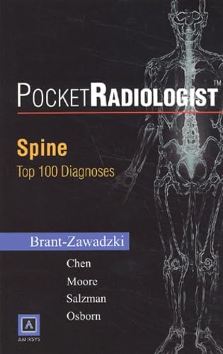 PocketRadiologist - Spine: Top 100 Diagnoses