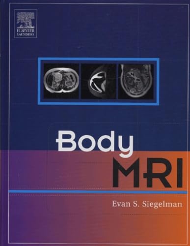 Body MRI