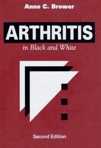 Arthritis: in Black and White