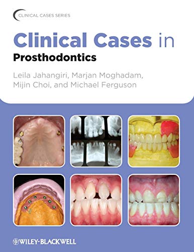 Clinical Cases in Prosthodontics (Clinical Cases (Dentistry))
