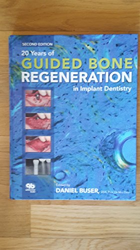 20 Years of Guided Bone Regeneration in Implant Dentistry