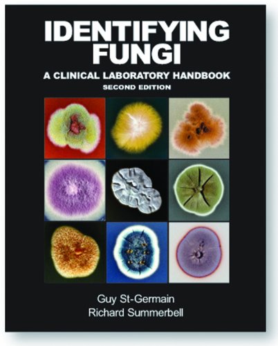 Identifying Fungi: A Clinical Laboratory Handbook