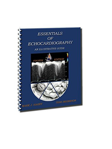 Essentials of Echocardiography An Illustrative Guide