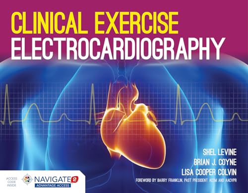 Clinical Exercise Electrocardiography: .