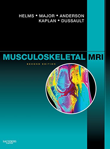 Musculoskeletal MRI