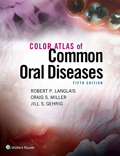 Color Atlas of Common Oral Diseases: .