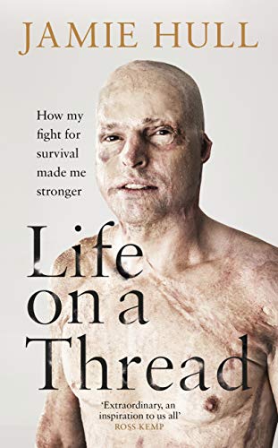 Life on a Thread: How my fight for survival made me stronger