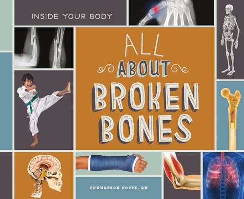 All About Broken Bones (Inside Your Body)