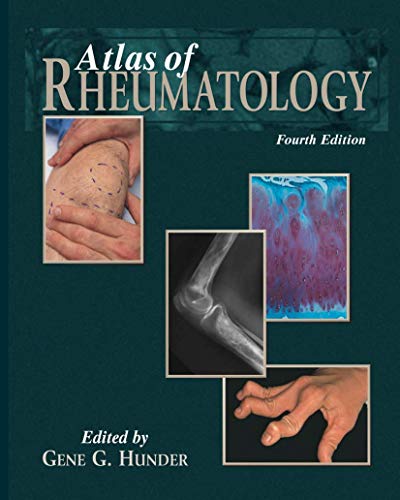 Atlas of Rheumatology