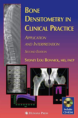 Bone Densitometry in Clinical Practice: Application and Interpretation (Current Clinical Practice Series)