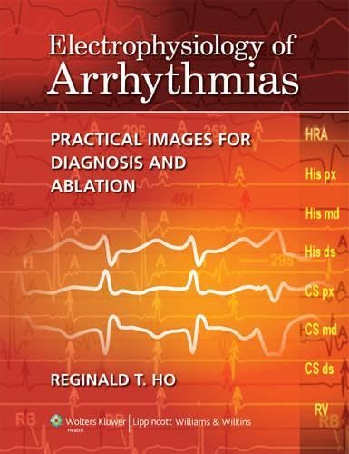 Electrophysiology of Arrhythmias: Practical Images for Diagnosis and Ablation