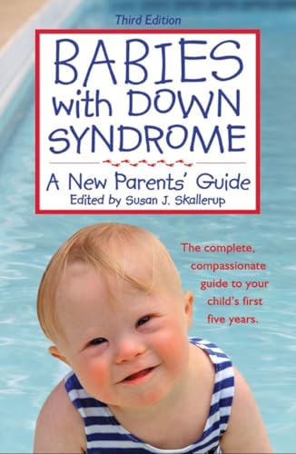 Babies With Down Syndrome: A New Parents' Guide