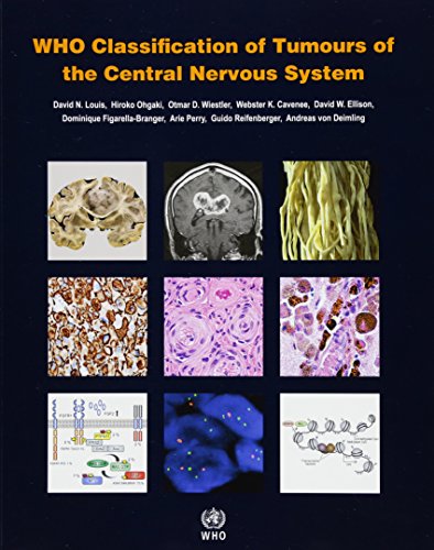 WHO Classification of Tumours of the Central Nervous System OP