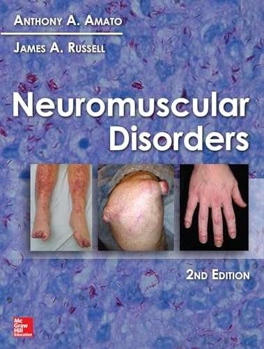 Neuromuscular Disorders, 2nd Edition